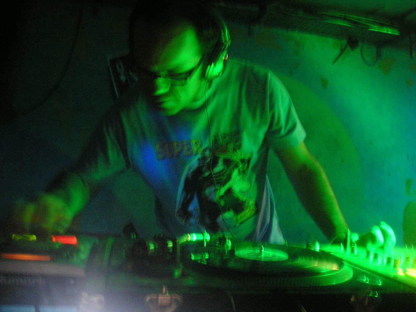 Unfortunately, the MRI scans of my tumour have been lost. But this gives you a pretty good idea. Image courtest of Mayfield Clinic