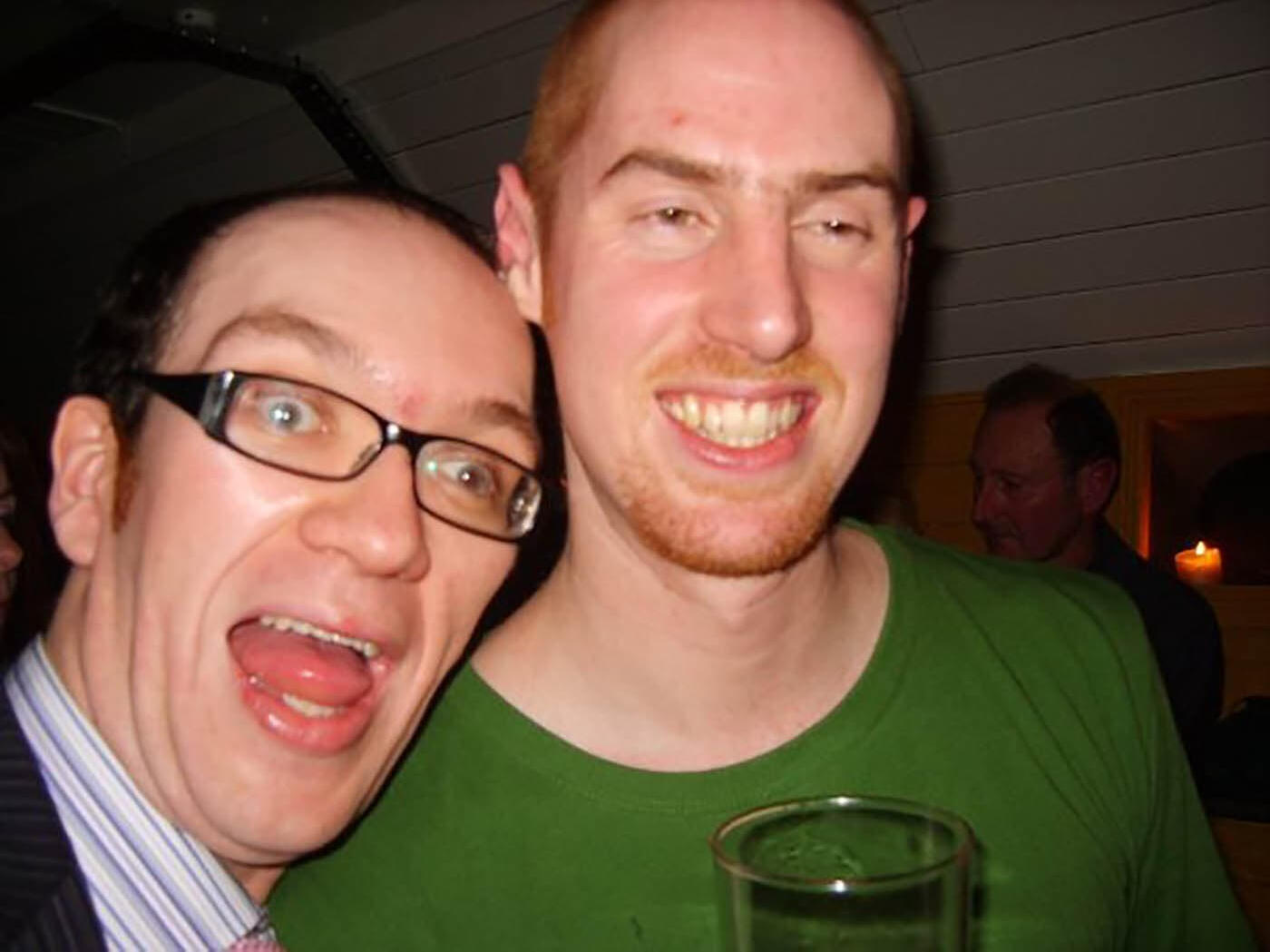 You can literally see the Acromegaly leaving my face