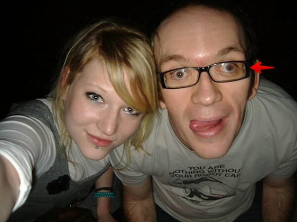 I doubt the surgeons call them ‘tumour scoops’. They&#39;re really called ‘curettes’. Image courtesy of www.marketlab.com